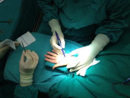 Σύνδρομο Καρπιαίου Σωλήνα(CARPAL TUNNEL SYNDROME)
